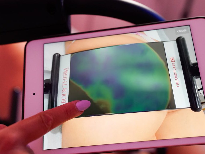 Il tablet della lastra: sulla schiena la mappa del calore, con le zone in verde e in blu dove il corpo trattiene